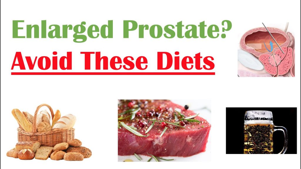 What Foods Should You Avoid For Prostate 2024